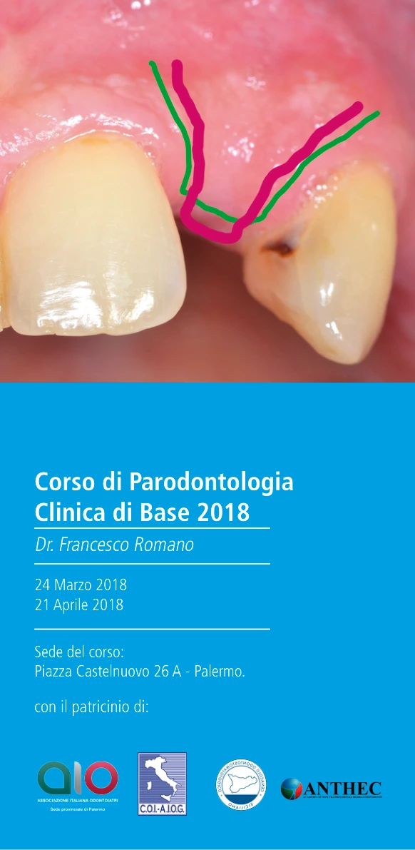 Brochure 2018: Parodontologia Clinica di Base